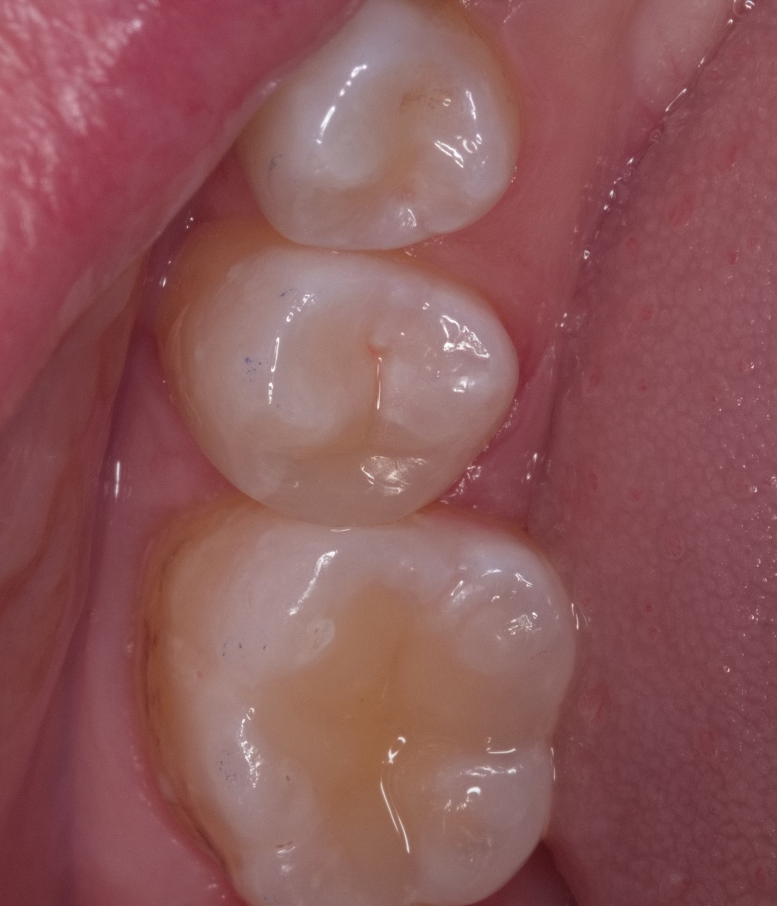 Фото клиники Smile Центр